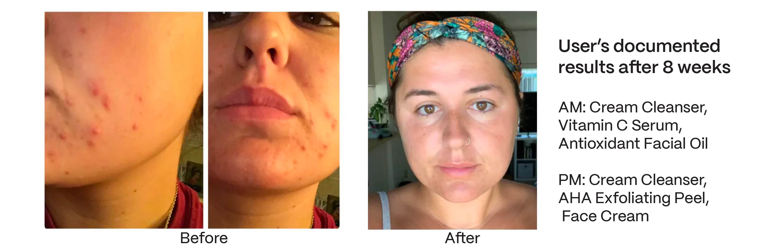 Vitamin C Serum brings results