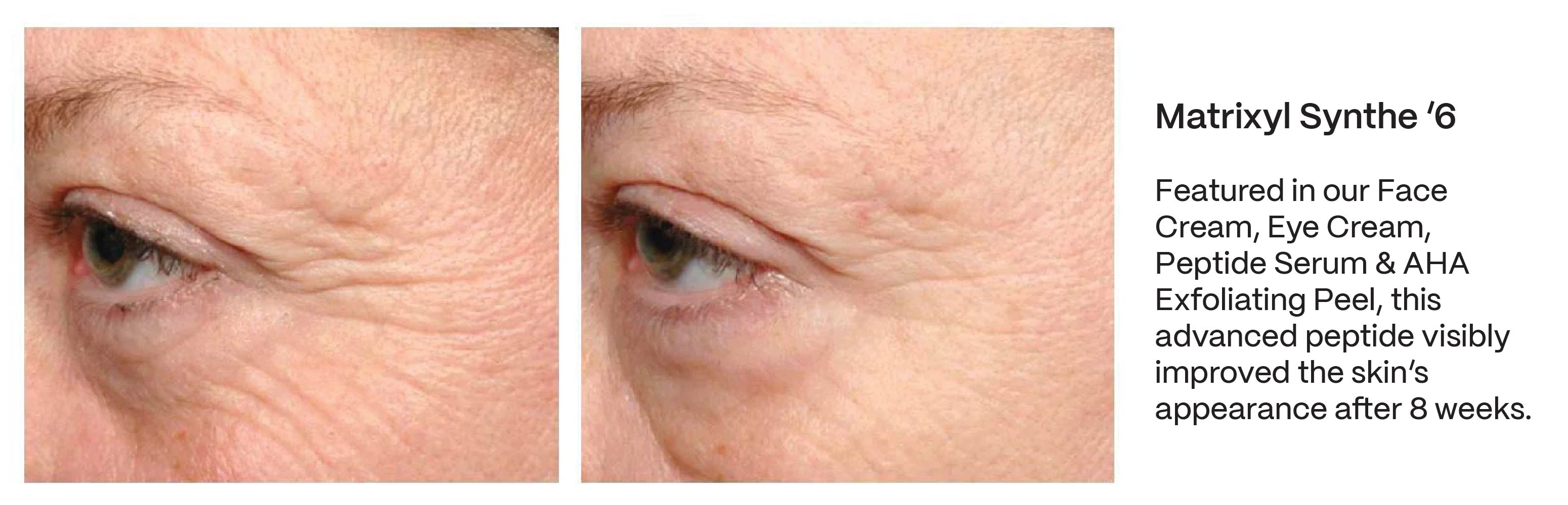 Peptide skincare before and after