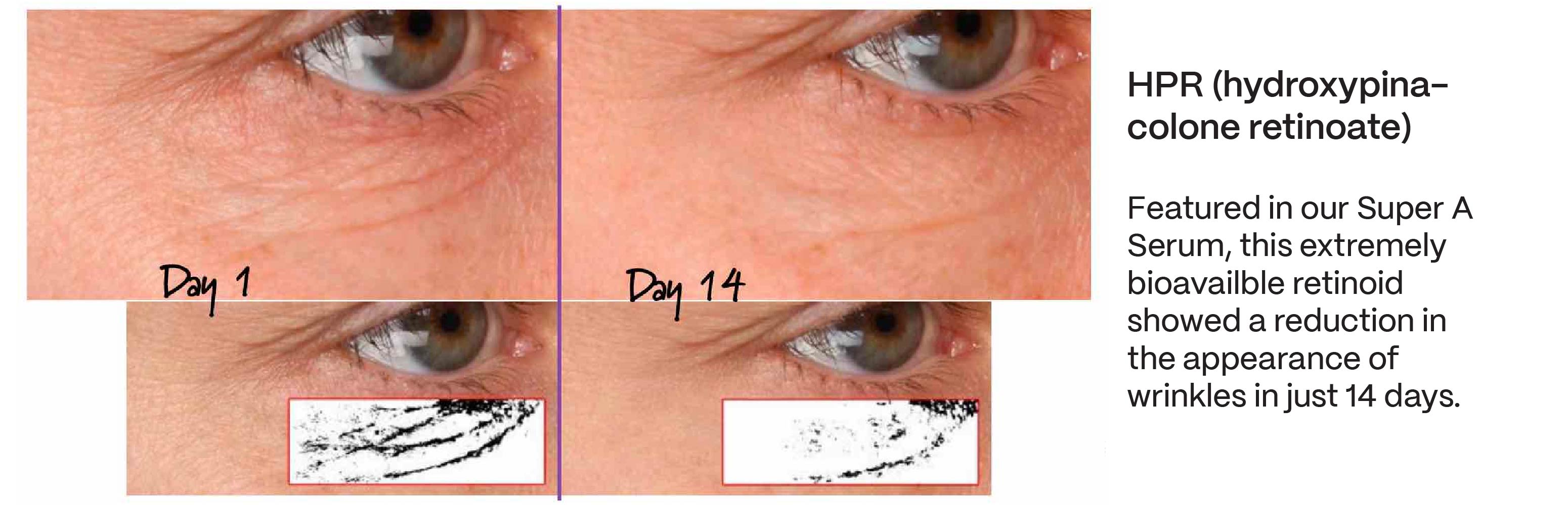skincare before and after