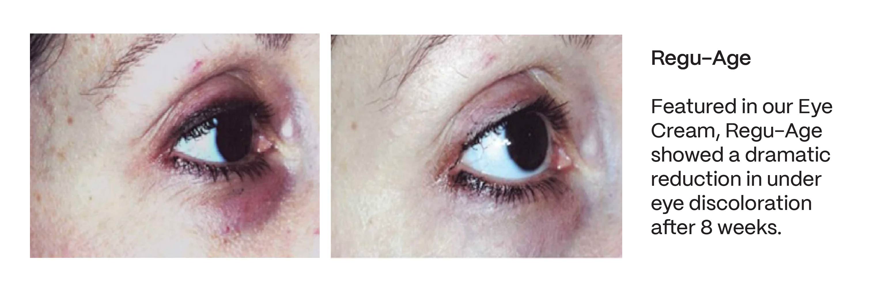 natural skincare before and after results