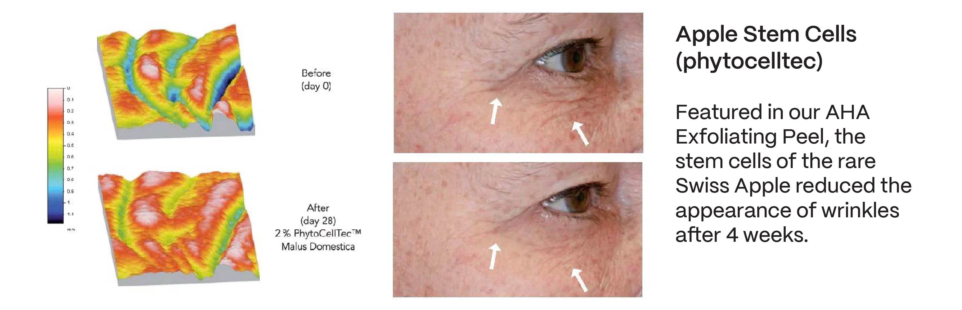 skincare before and after