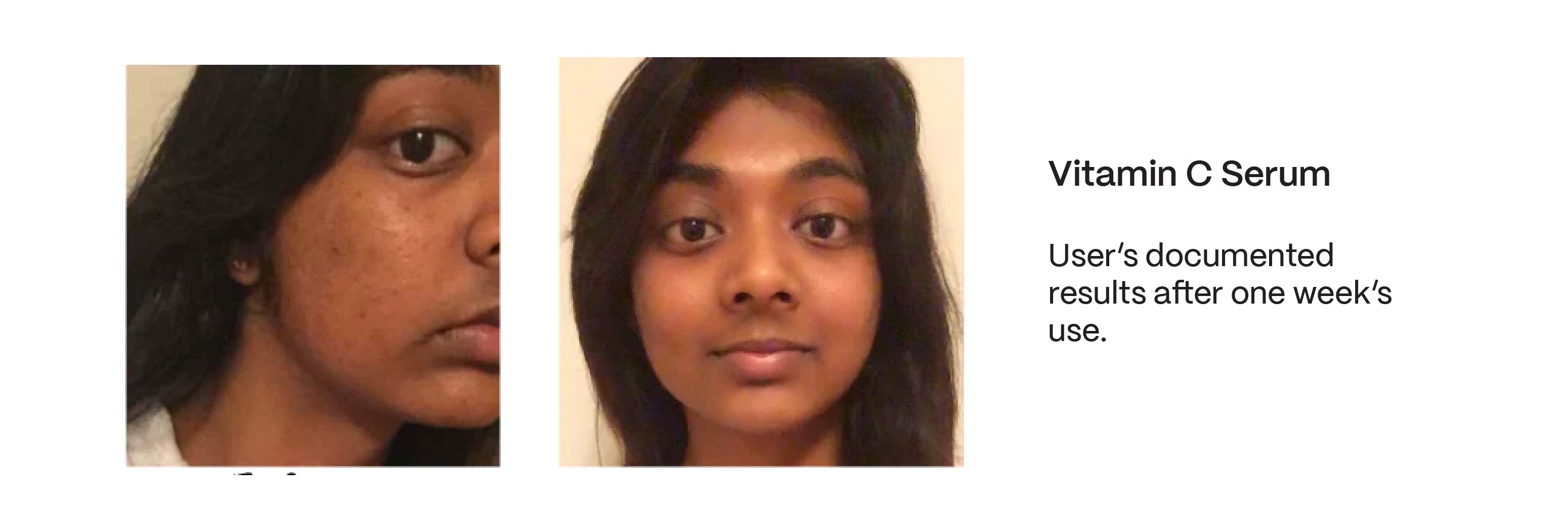 Vitamin C Serum results image